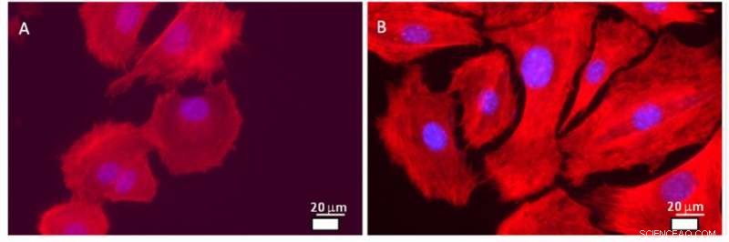 Improved Body Response to Implants: New Surface Treatment Cuts Rejection