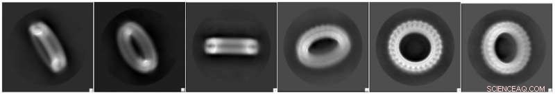 Scientists Unveil 3D Structure of Key Protein Driving Inflammatory Diseases