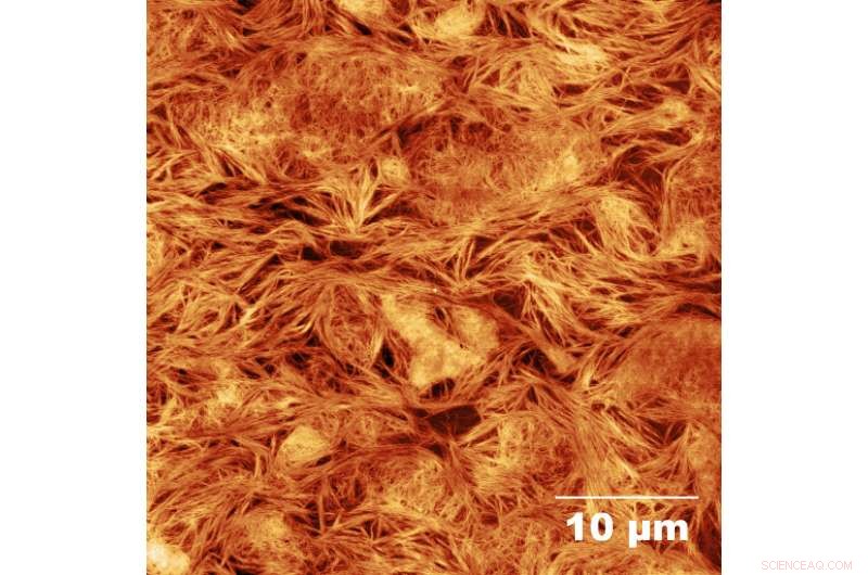 Optimizing Beta Peptide Design for Advanced Neuroregeneration