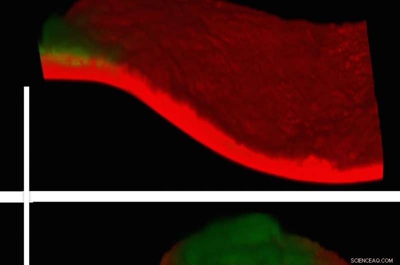 Innovative Hydrogel Safely Removes Tape from Century-Old Michelangelo Drawing