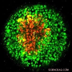 Creating a Human Stem Cell Model to Study Nervous System Development