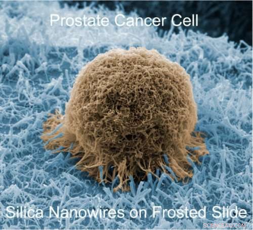 Affordable Sensor Acts Like Velcro to Capture Prostate Cancer Cells