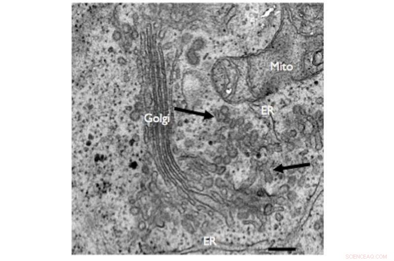 New Enzyme Reveals Key Role in Collagen Carrier Formation and Secretion Suppression