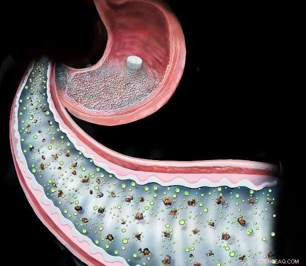 Pill‑Based Surgery: A Promising New Diabetes Treatment