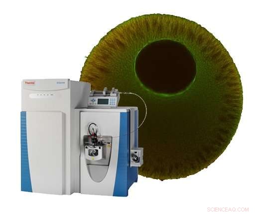 New Proteomics Method Improves Protein Quantification Accuracy