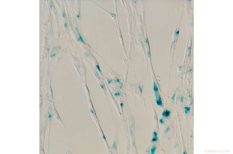 Gene Activation Halts Cell Division, New Study Reveals