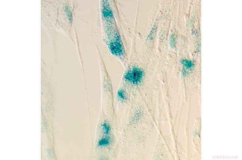 Gene Activation Halts Cell Division, New Study Reveals