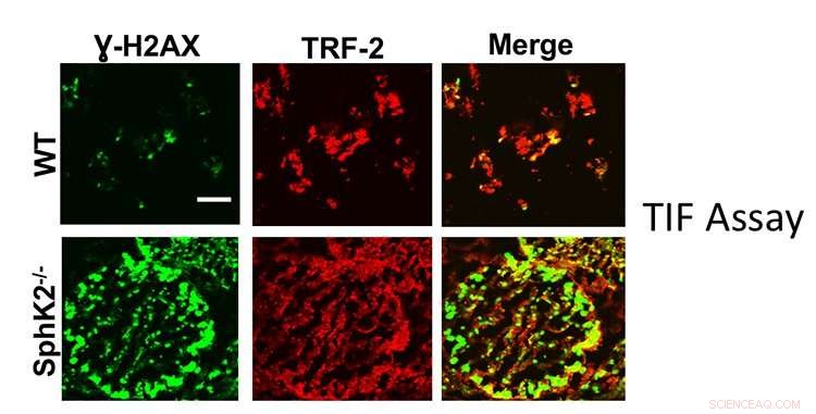 Scientists Uncover Cellular Connection Between Cancer and Aging