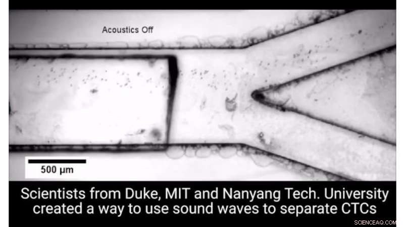 New Acoustic Microfluidic Platform Rapidly and Gently Isolates Circulating Tumor Cells from Blood Samples