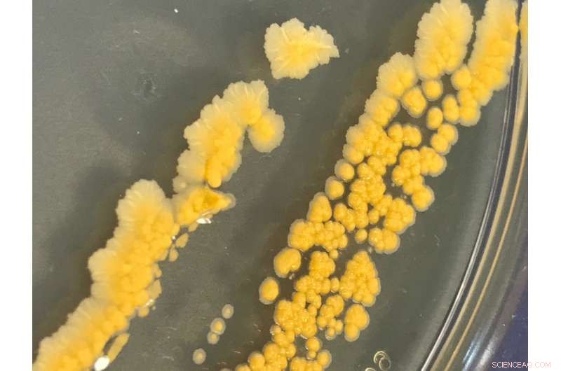 University of Warwick Breaks New Ground with Antifreeze-Inspired Bacterial Cryopreservation