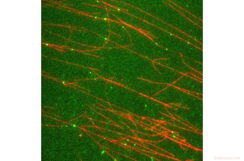 Scientists Unveil 3D Model of Motor-Cargo Complex Driving Ciliary Transport