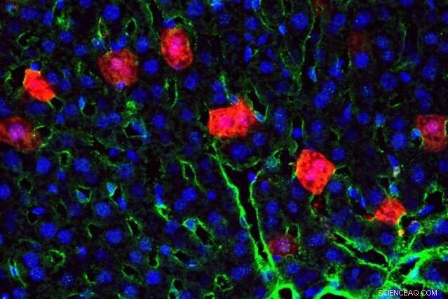 New Materials Enhance Targeted mRNA Delivery via Nanoparticles