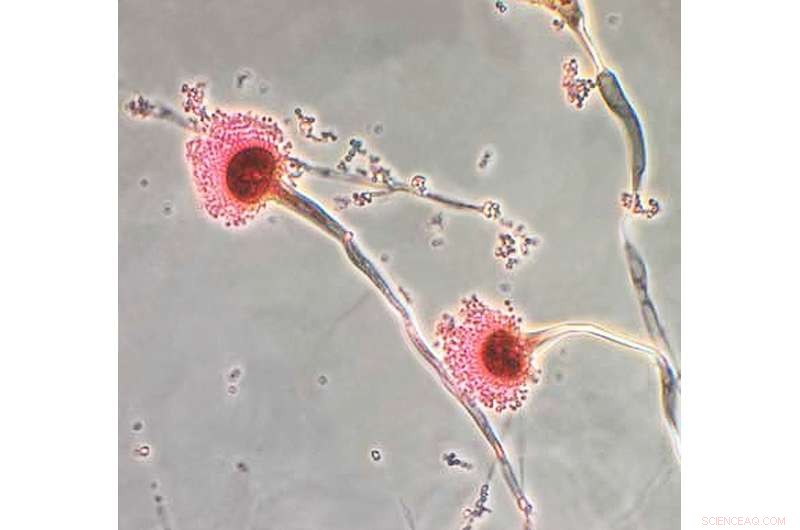 LSU Chemists Unveil Cell Wall Structure of Deadly Aspergillus fumigatus