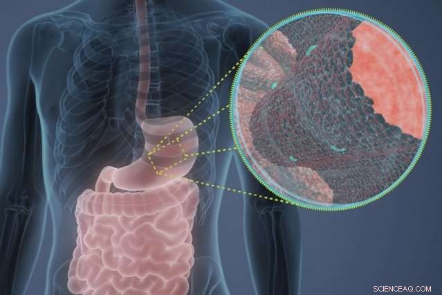 MIT Study Reveals New Antimicrobial Peptides in Human Stomach Lining
