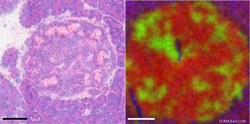 Mapping Cancer Cell Migration: Unveiling Tumor Cell Movements