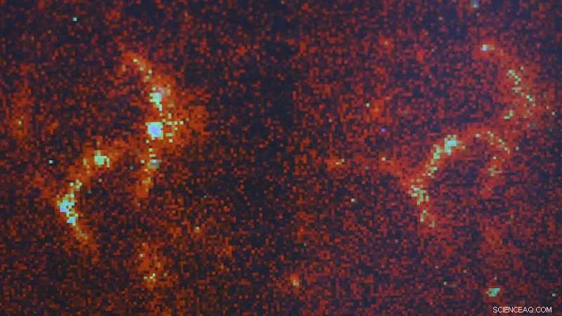 New Fluorescence Technique Lets Scientists Visualize Tiny Amyloids