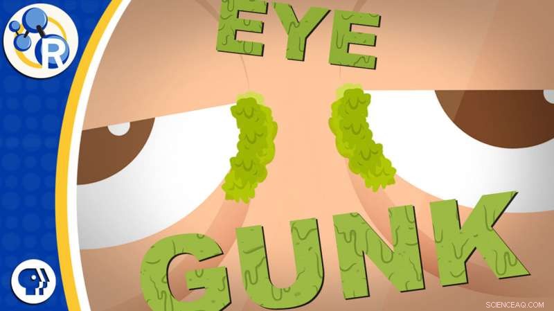 Video Explains the Composition of Eye Crusts (Eye Crusties)