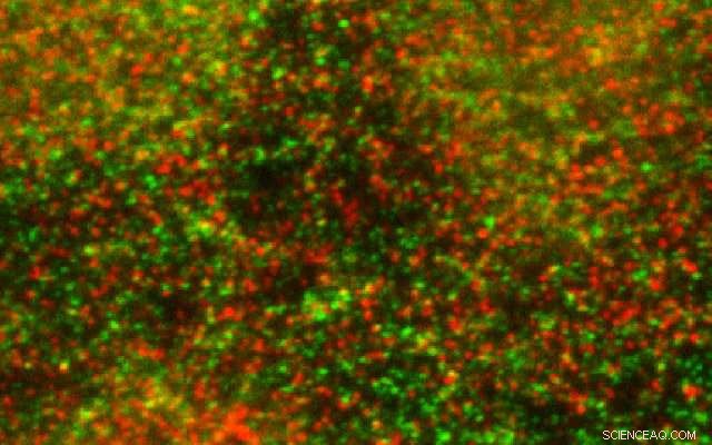 How Cells Rewire Their Waste Management to Fuel Inflammation