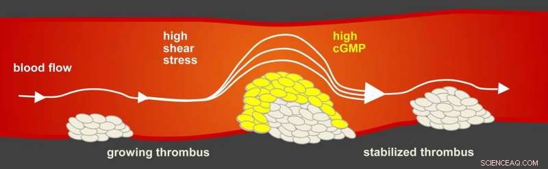 Arterial Antilock Brake System Naturally Shields Against Heart Attacks