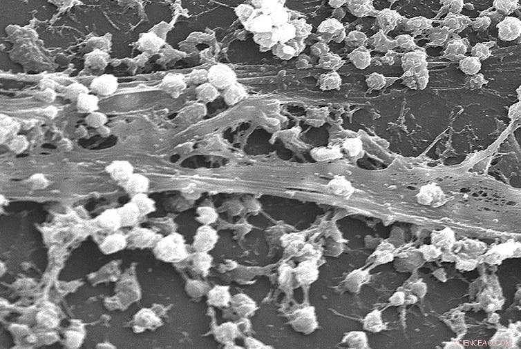 Scientists Battle Biofilm Infections: New Strategies Against Resistant Bacteria