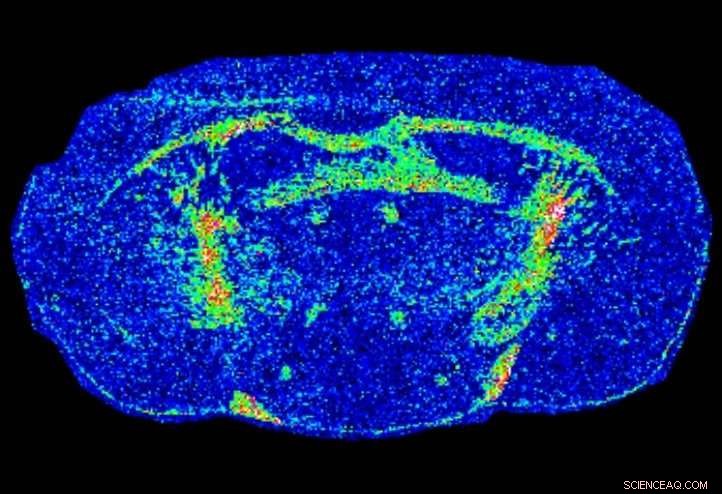 Enhancing Mass Spectrometry and Imaging with Conjugated Polymers