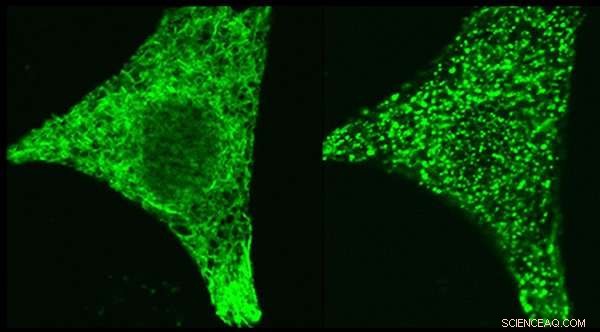 Scientists Uncover Protein Pair That Controls Cellular Calcium Signals