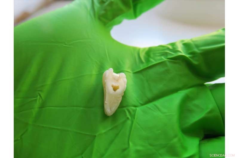 Revolutionary Bio-Compatible Material Promises Durable, Long-Lasting Dental Fillings