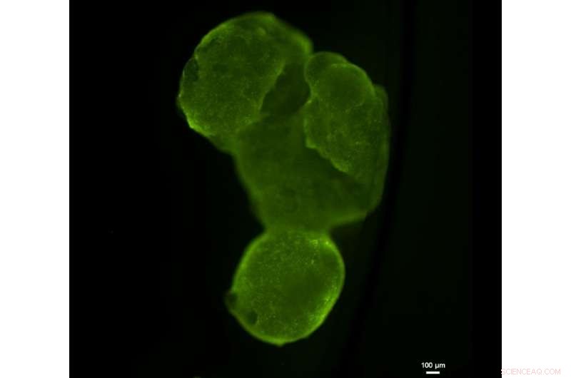 Scientists Create Fully Personalized Tissue Implants Using Patients  Own Cells