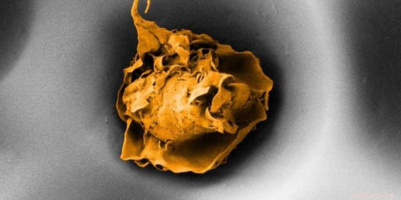 Why Macrophages Stay Dormant in Healthy Tissue: ETH Study Findings