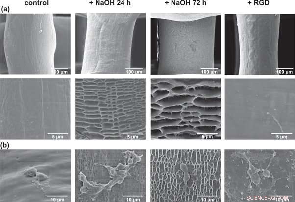 Boosting Bone Formation: Pre-Osteoblast Response to Surface-Enhanced 3‑D Printed Scaffolds