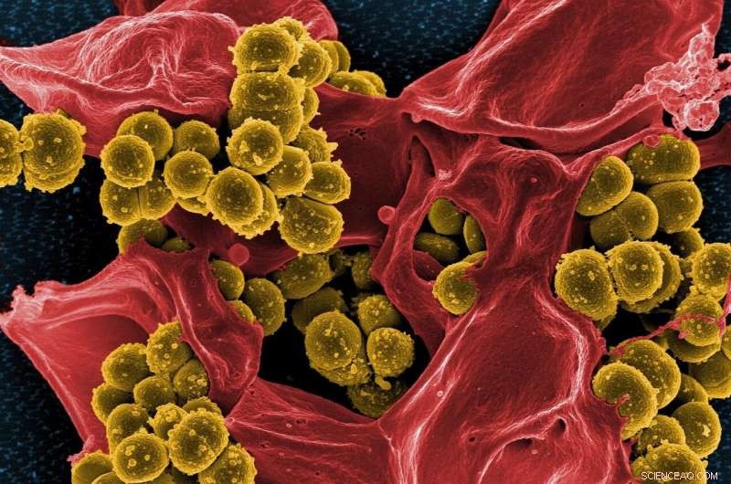 New Chemical Synthesis Method Promises Effective Antibiotics Against Drug‑Resistant Infections