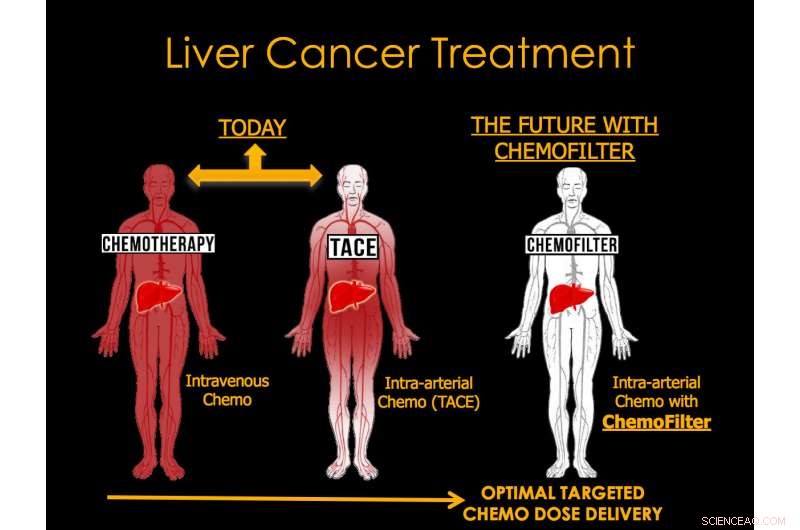 3D-Printed Drug Sponge Promises Lower Side Effects in Cancer Treatment