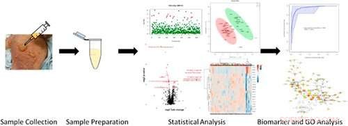 Using Blister Fluid to Accurately Assess Burn Severity