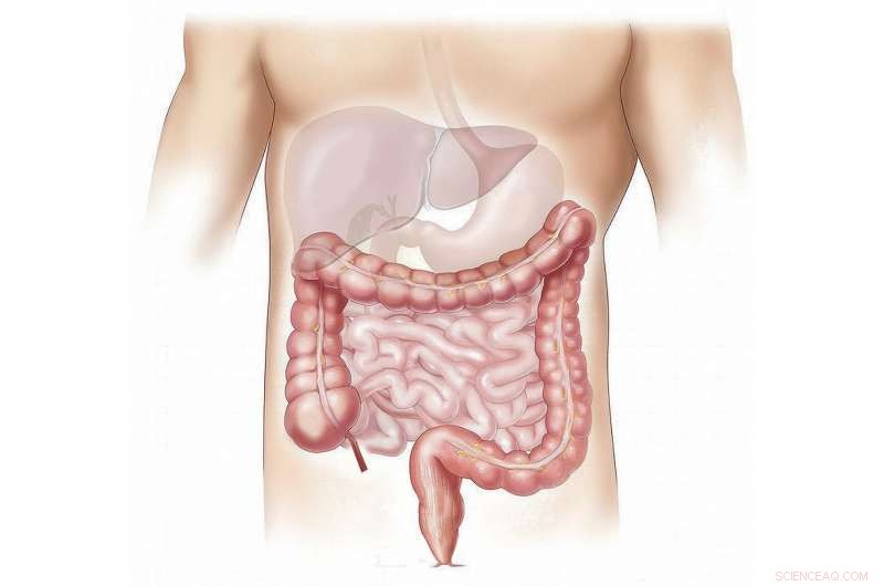 Dietary Fiber Polymers Shape the Small Intestine by Aggregating Solid Particles