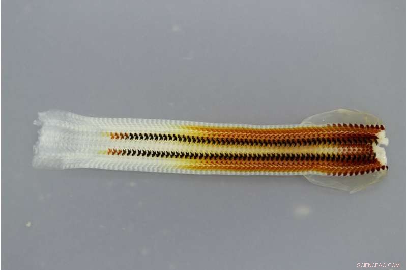 Mollusk’s Magnetic Teeth Promise Next-Gen Materials & Energy Solutions