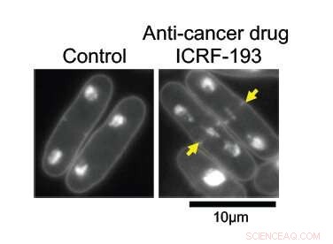 ICRF‑193 Unveils Anti‑Cancer Mechanism in Yeast Cells