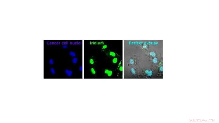 Iridium-Based Metal Compound Kills Cancer Cells When Activated by Light