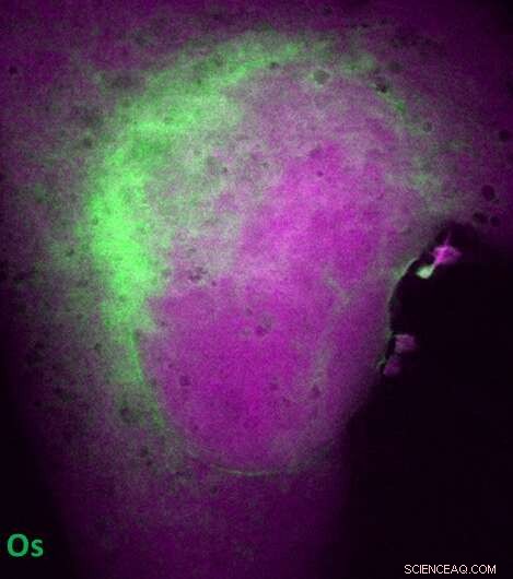Mapping the Pathway of a Metallodrug in Breast Cancer Cells