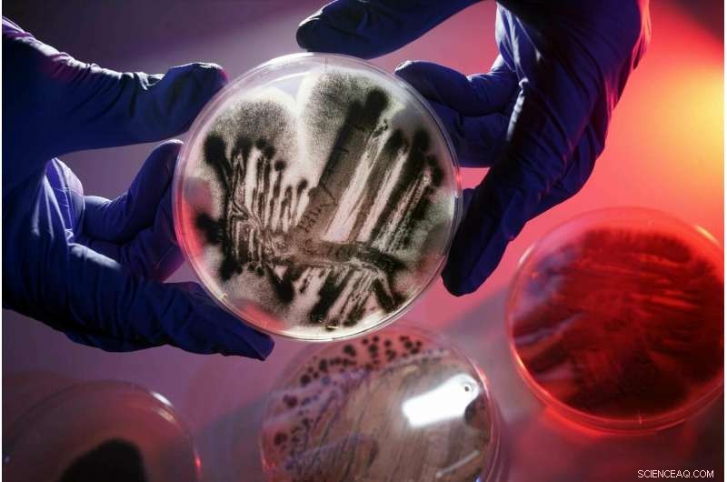 The Hidden Threat: How Aspergillus Fumigatus Undermines Your Immune System