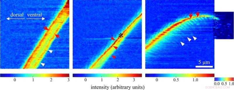 PETRA III X-ray Imaging Uncovers Spider Leg Adhesive Hair Structures