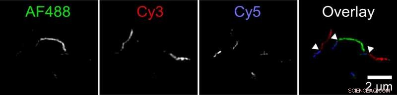 Unraveling How Tau Protein Tangles Grow in Alzheimer’s Disease