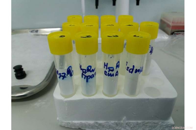 New Physics-Based Technique Detects Antibiotic-Resistant Bacteria