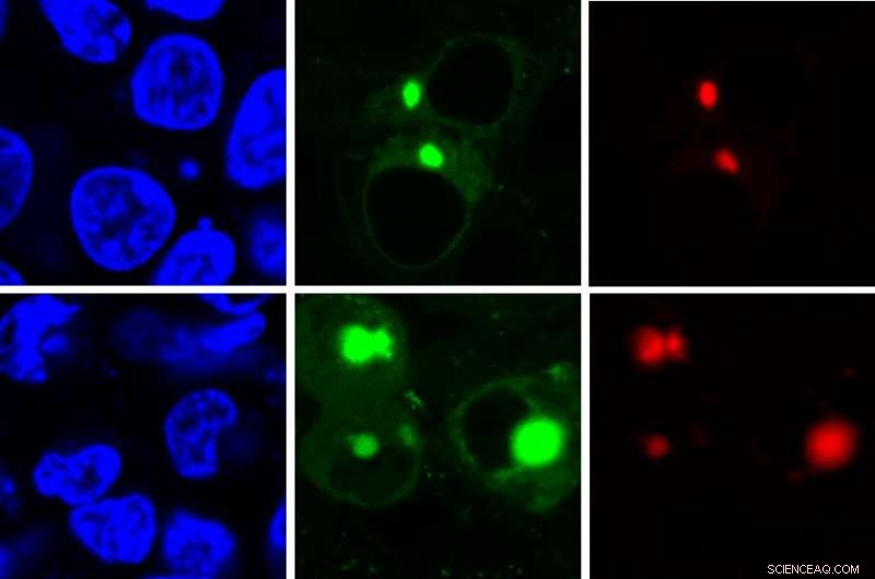 Fluorescence-Based AggTag Method Reveals Hidden Disease‑Causing Protein Intermediates