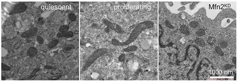 Mitochondrial Fusion Enhances Cell Division: A Key Cellular Mechanism