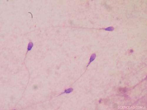 Microchip Sperm Racing Device Promises Faster, Safer DNA Testing