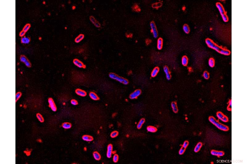 Engineered Microbe Could Unlock Plant-Based Plastic Production