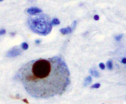 Breakthrough: Researchers Unveil Mechanism of Previously Undruggable Parkinson s Molecule