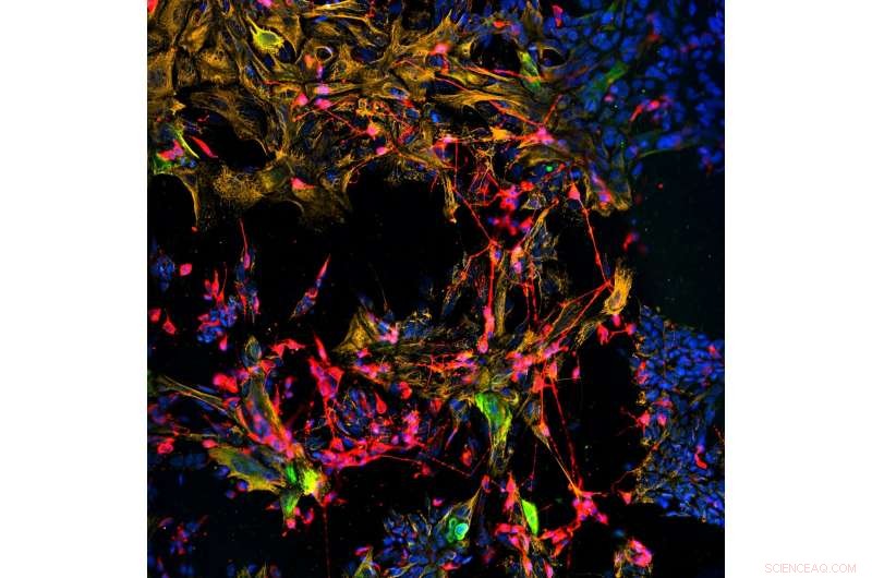 Cultured Stem Cells Regenerate Nasal Sensory Nerve and Epithelium