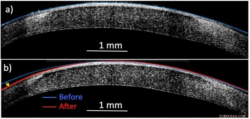 Revolutionary Electric Molecular Surgery Reshapes Living Tissue Noninvasively