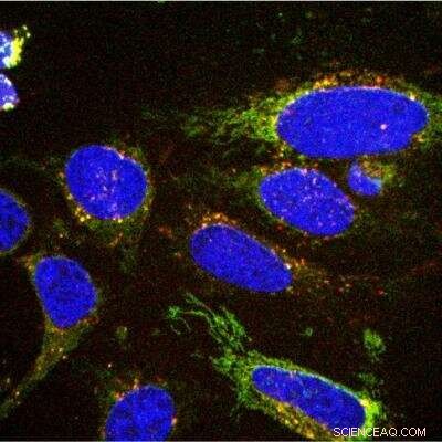 Advanced Imaging of Cellular Metabolism Promises Improved Cancer Diagnosis